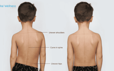 Your Child’s Posture is a Window Into Their Nervous System Health